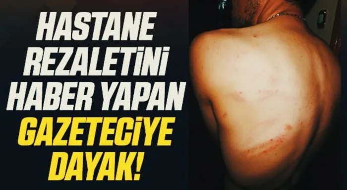 Samsun'da Hastane Rezaletini Haber Yapan Gazeteciye Dayak!