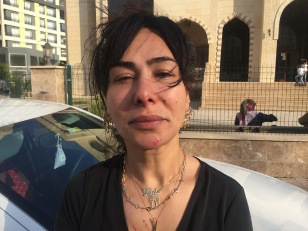 Korkunç İddia! Evde, asansörde taciz edip işkence yaptı - Resim 6