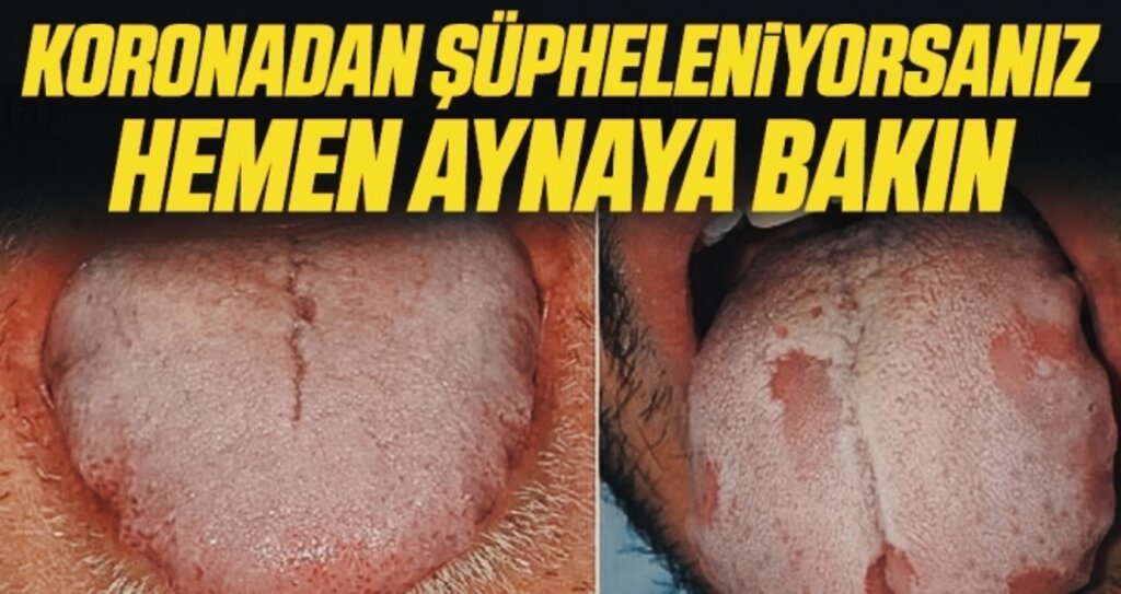 Koronadan şüpheleniyorsanız hemen aynaya bakın!