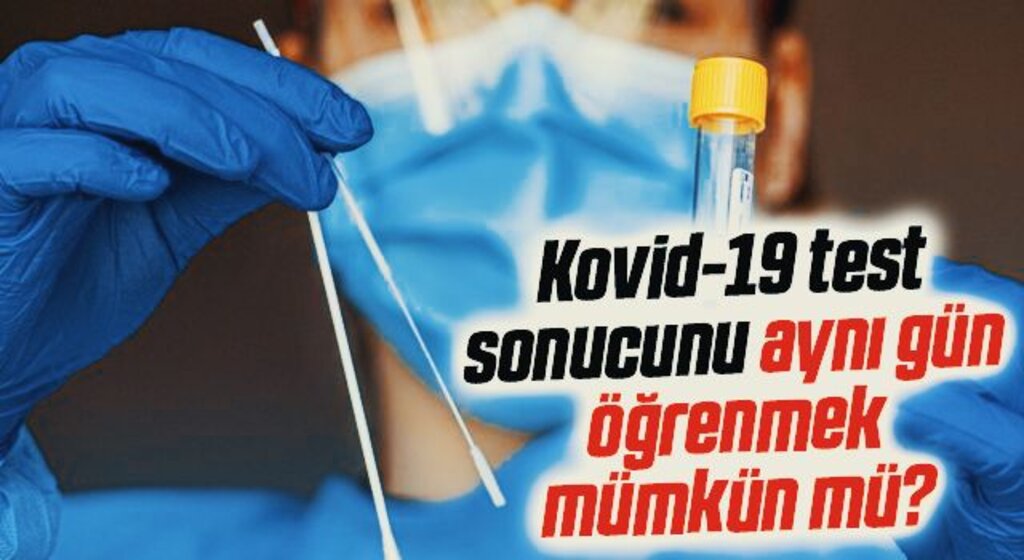 Kovid-19 test sonucunu aynı gün öğrenmek mümkün mü?