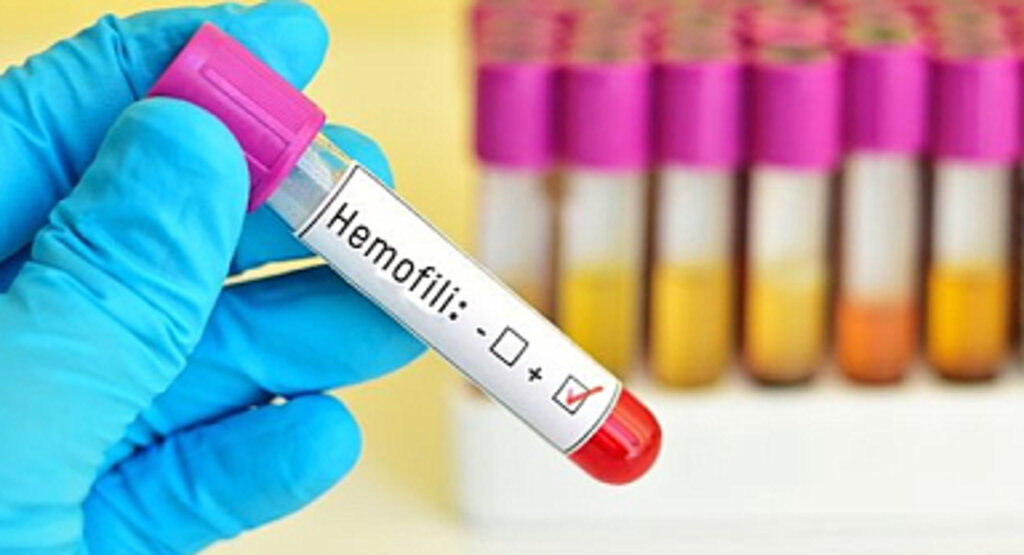 Dünya Hemofili Günü: Hemofili Nedir ve Nasıl Tedavi Edilir?