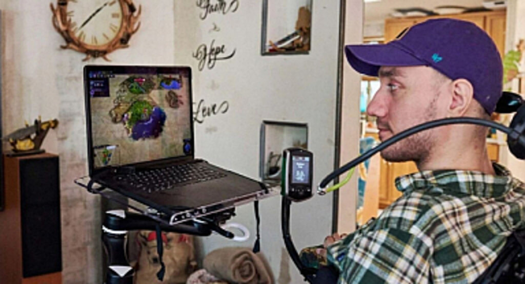 Neuralink ile Beynine Çip Takılan İlk Kullanıcıdan Açıklama!