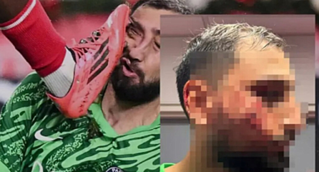 Donnarumma’ya Yapılan Faul Futbol Dünyasını Sarstı