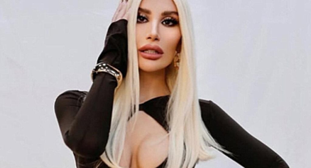 İrem Derici Kaza Geçirdi: Hastaneye Kaldırıldı
