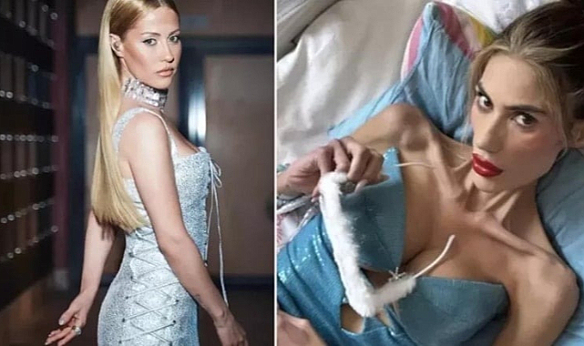 Derya Uluğ'dan Anoreksiya İtirafı: 39 Kiloya Kadar Düşmüştüm