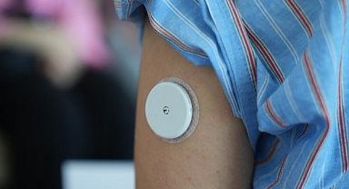 Diyabet Derneği'nden Çağrı: Şeker Sensörü Yaş Sınırı Kaldırılsın