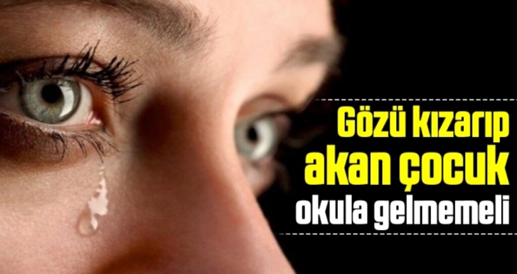 Gözü Kızarıp Akan Çocuk Okula Gelmemeli