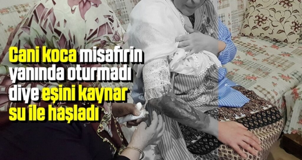Cani koca misafirin yanında oturmadı diye eşini kaynar su ile haşladı