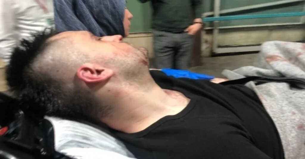 Komşu Aileler Park Yüzünden Kavga Etti: 1 Yaralı