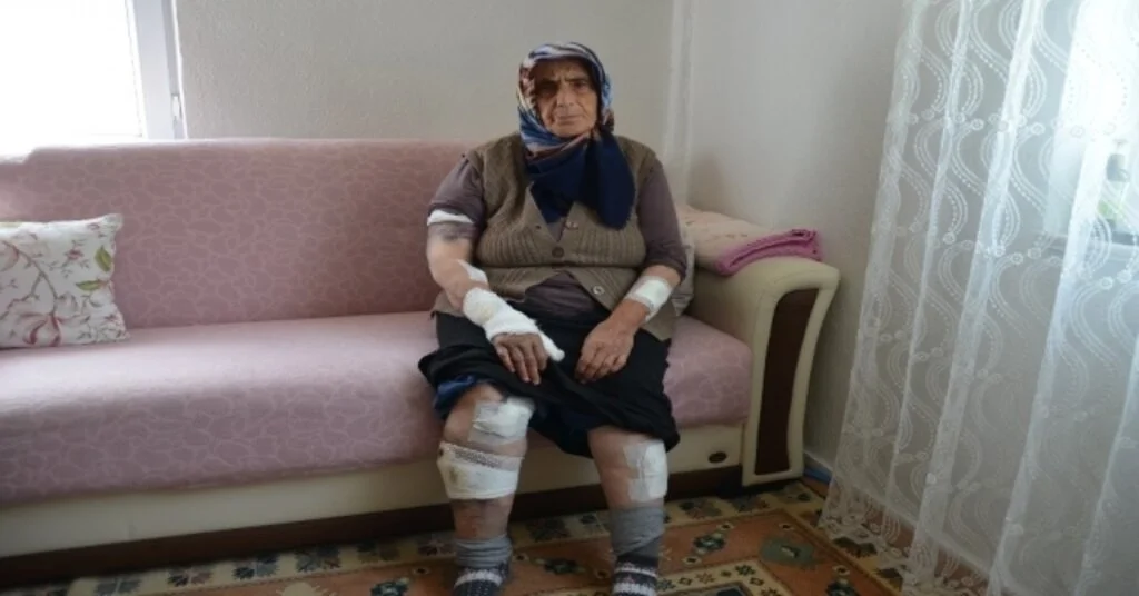 Köpeklerin Saldırdığı Yaşlı Kadını Ölümden Komşuları Kurtardı