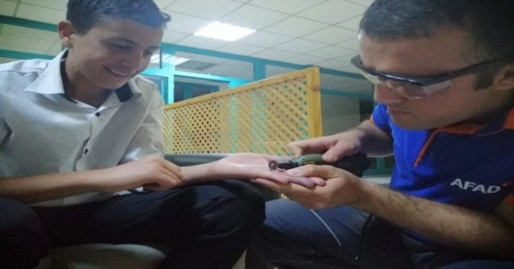 Afad Ekipleri, Parmakta Sıkışan Yüzüğü Çıkarttı