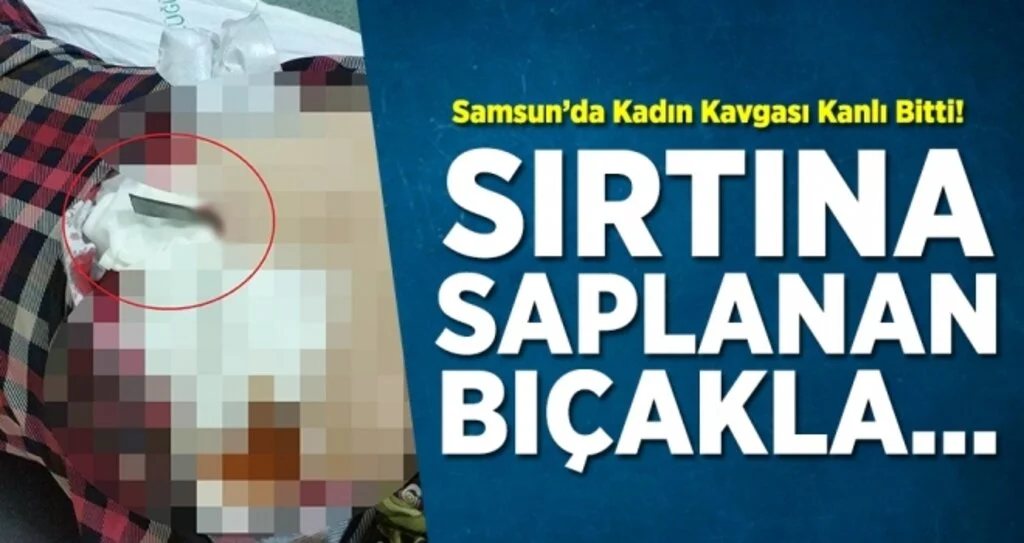 Samsun'da Kadın Kavgası Kanlı Bitti!