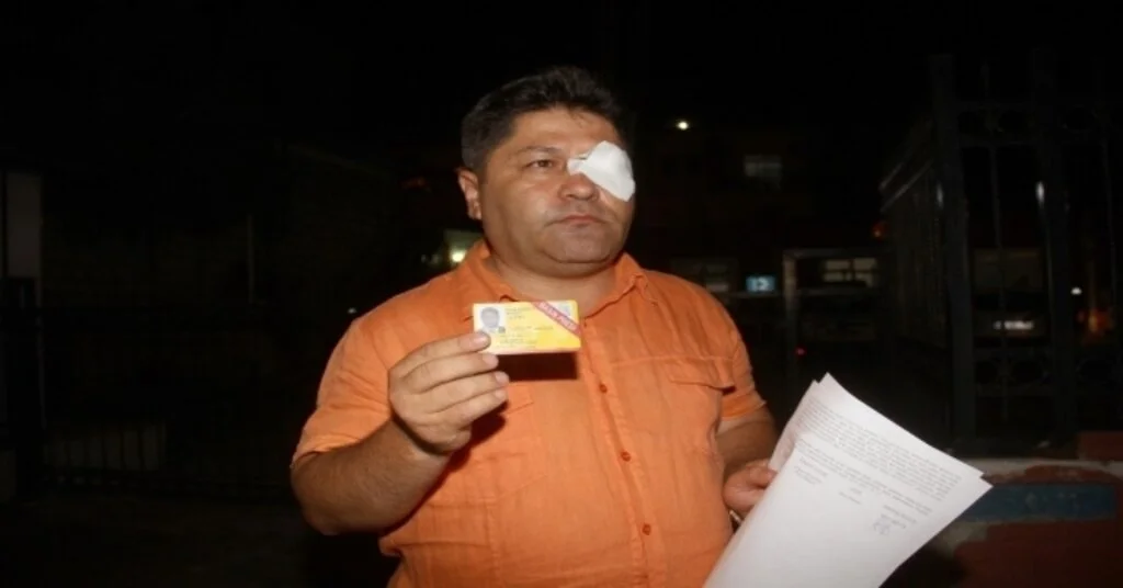 Fethiyede Gazeteciye Saldırı