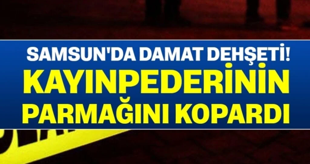 Samsun'da damat dehşeti! Kayınpederinin parmağını kopardı