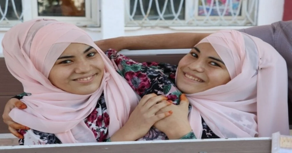 Siyam İkizleri Tercih Yapamadı