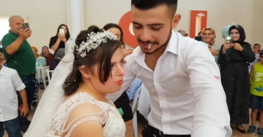 Down Sendromlu Rabiaya Damatsız Düğün
