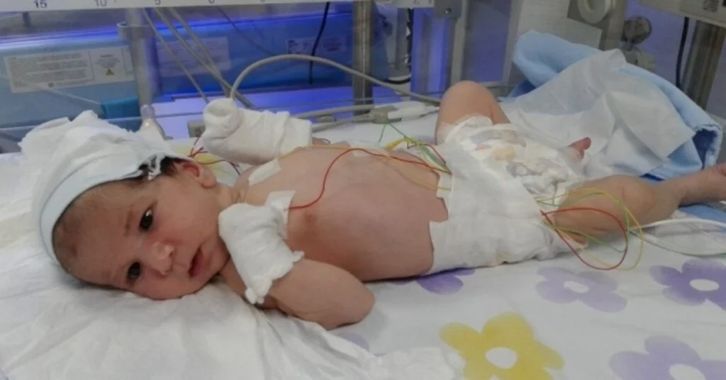 (Özel) Asel Bebek İçin ‘Yaşatın Çığlığı