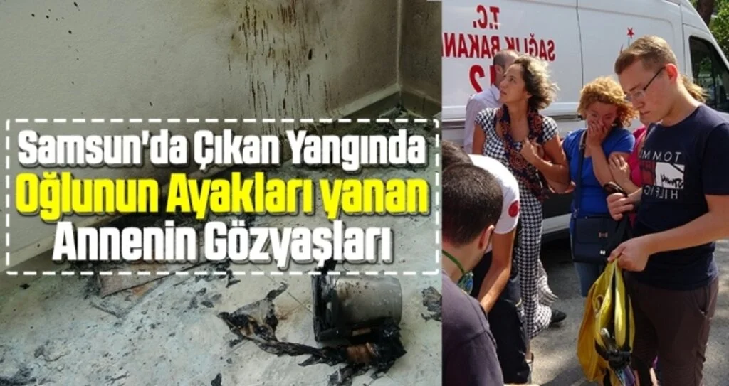 Samsun'da Çıkan Yangında oğlunun ayakları yanan annenin gözyaşları
