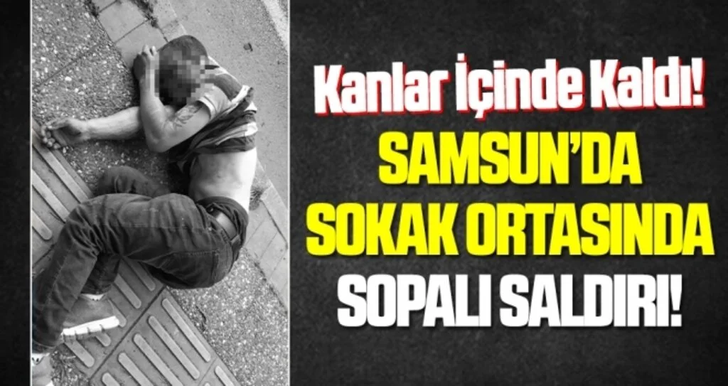Samsun'da sokak ortasında sopalı saldırıda kanlar içinde kalıp bayıldı