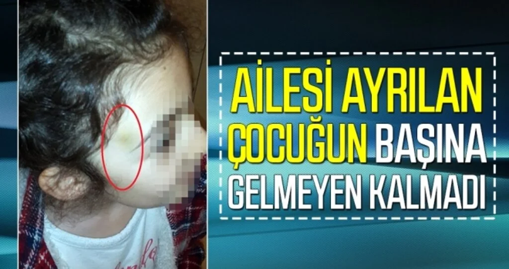 Ailesi ayrılan çocuğun başına gelmeyen kalmadı