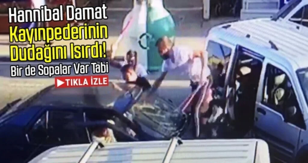 Hannibal Damat Kayınpederinin Dudağını Isırdı!