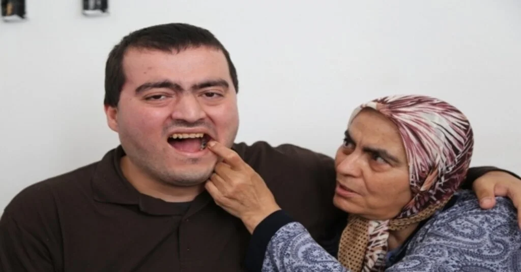 Zihinsel Engeli Tayfun Üç Aydır Diş Ağrısı Çekiyor