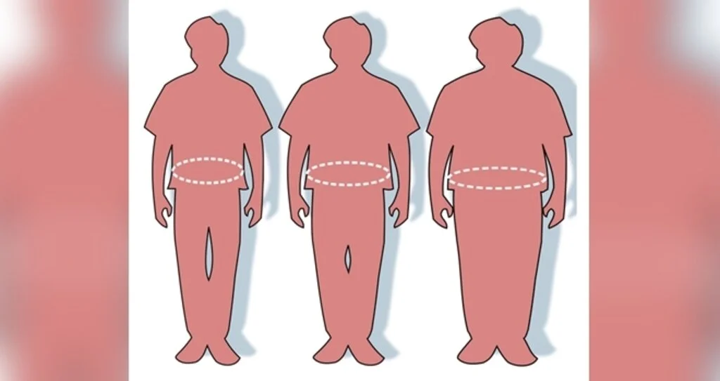 5 Soruda Obezite Hakkında Her Şey