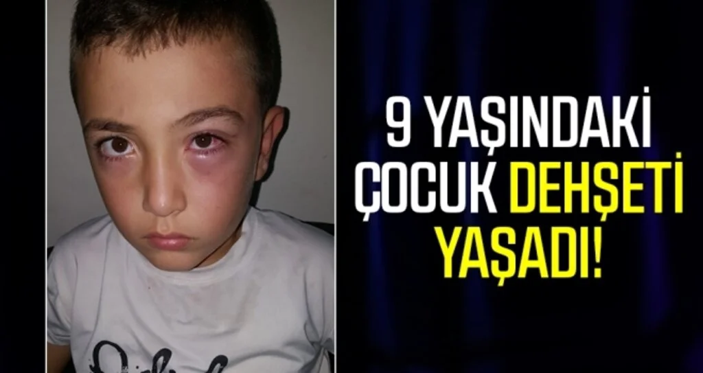 9 Yaşındaki Çocuk Dehşeti Yaşadı!