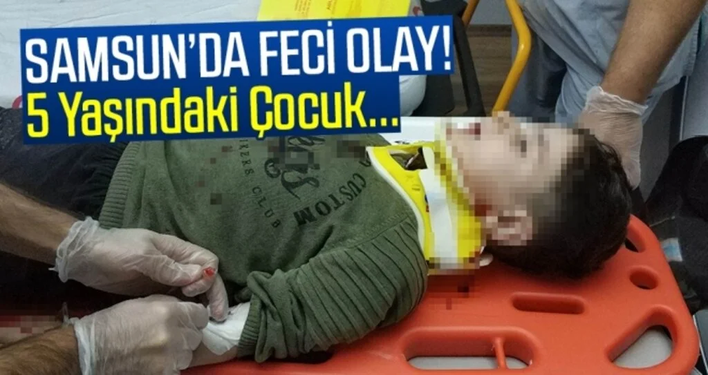 Samsun'da Feci Olay! 5 yaşındaki çocuk ağır yaralandı