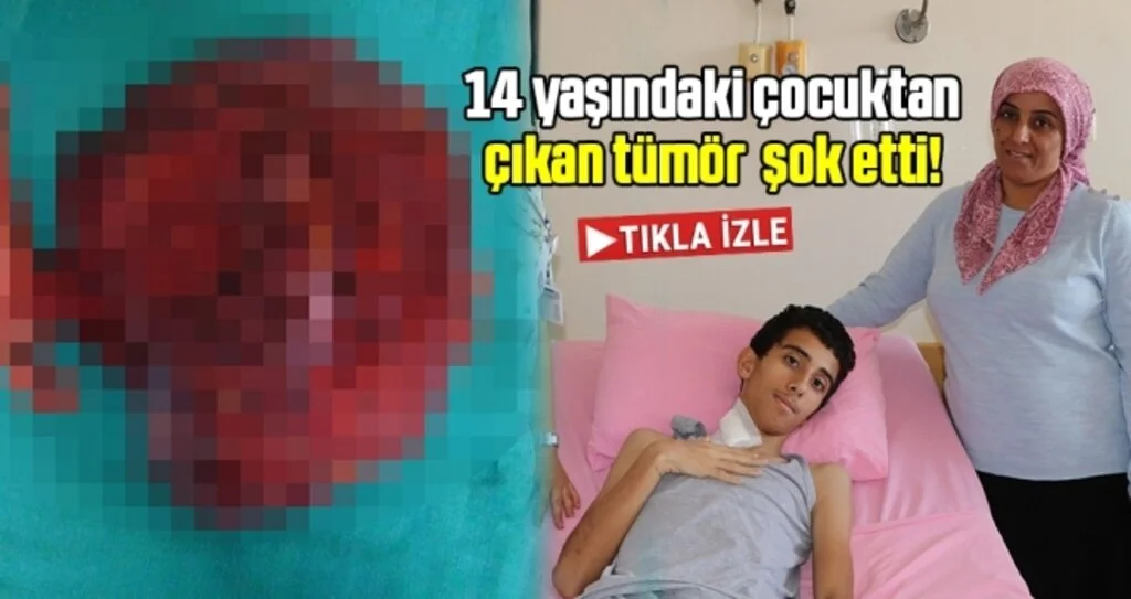 14 yaşındaki çocuktan 1,5 kiloluk ur çıktı