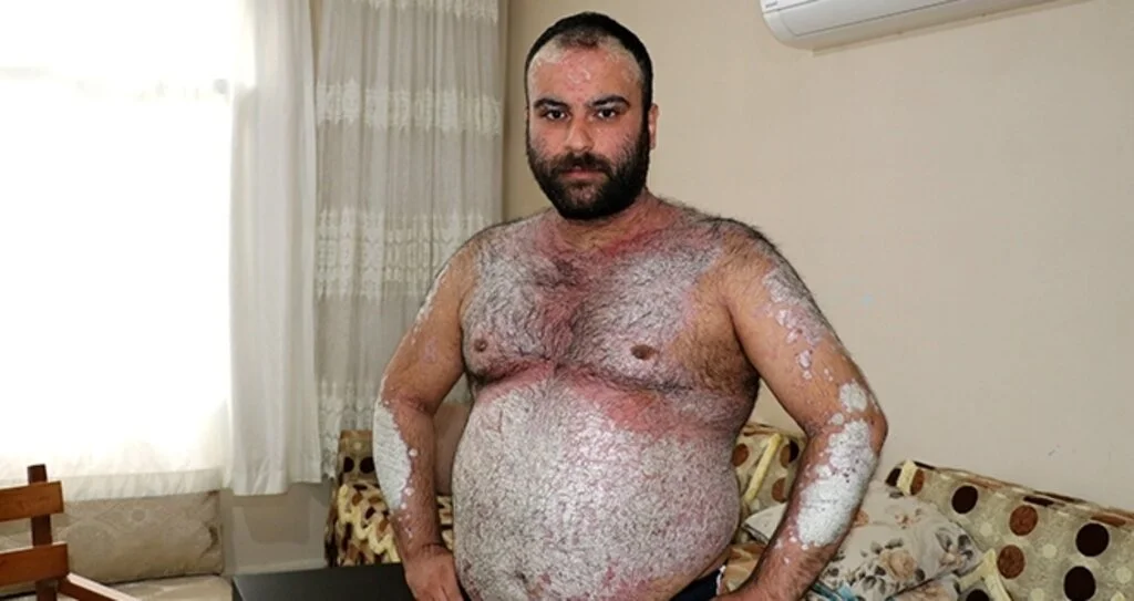 Kimse korkmasın diye dışarı çıkmıyor