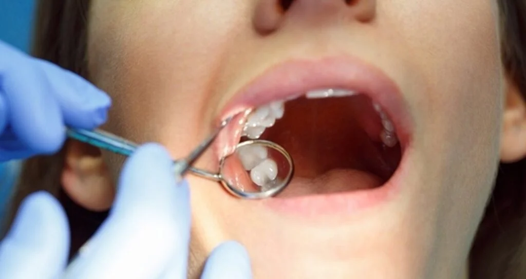 Kusursuz Dişler İçin implantdispoliklinigi.com