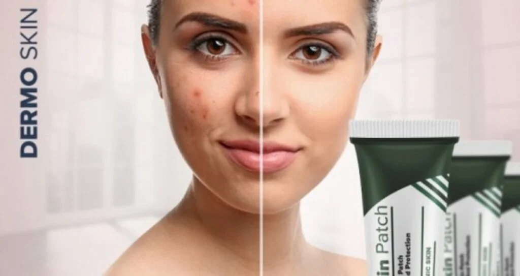 Memnuniyeti İle Birlikte Dermo Skin Patch ve Kullananlar