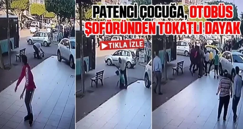Patenci Çocuğa, Otobüs Şoföründen Tokatlı Dayak