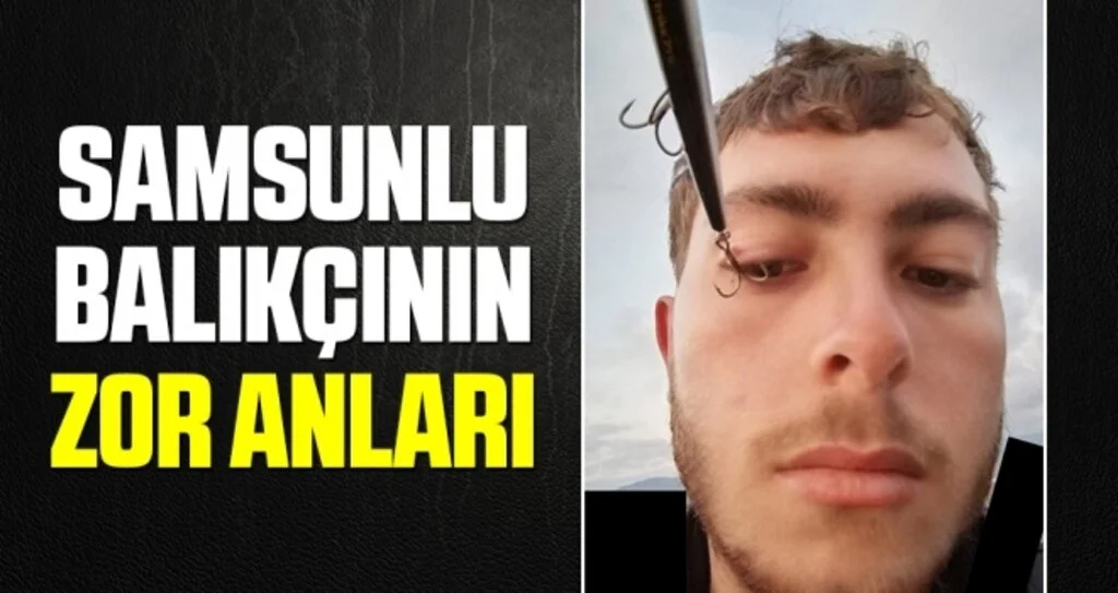 Samsun'da Amatör balıkçının göz kapağına  'olta iğnesi' saplandı