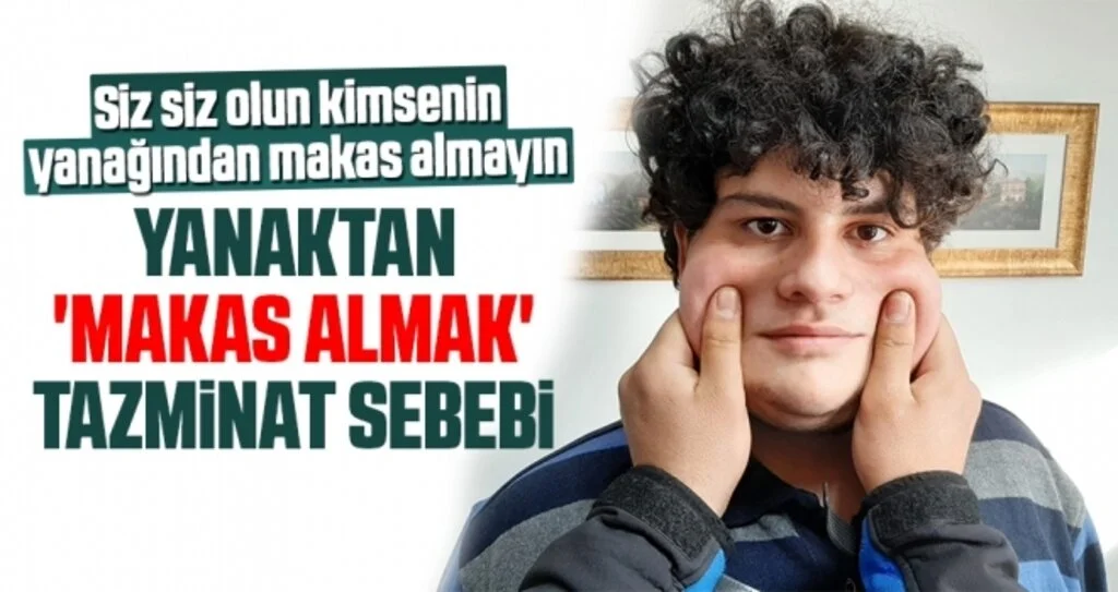 Yanaktan 'Makas Almak' Tazminat Sebebi