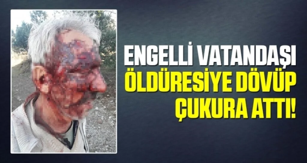 Engelli Vatandaşı Öldüresiye Dövüp Çukura Attı!