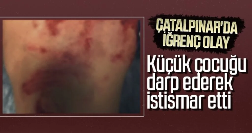 Küçük çocuğu darp ederek istismar etti
