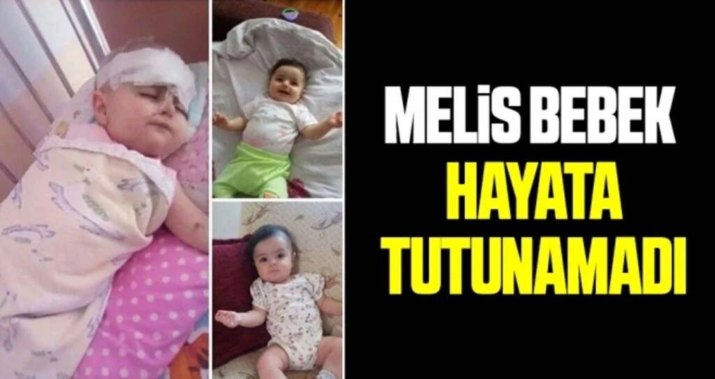 Melis Bebek Hayata Tutunamadı 