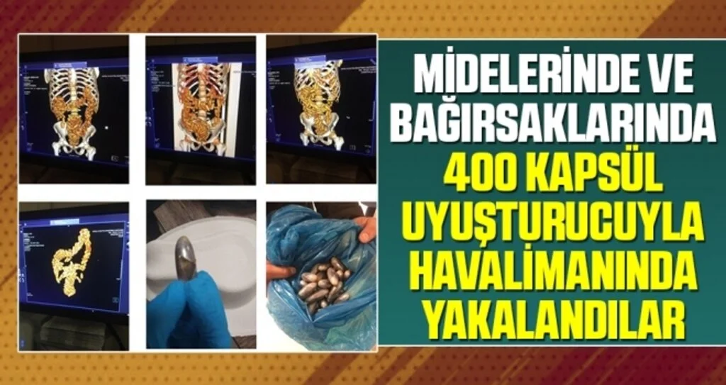 Midelerinde ve Bağırsaklarında 400 Kapsül Uyuşturucuyla Havalimanında Yakalandılar