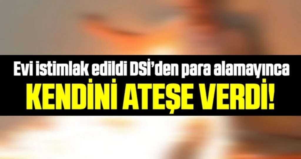 Samsun'da DSİ'den Para Alamadı Kendini Ateşe Verdi!
