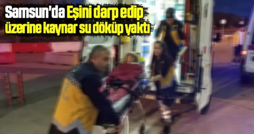 Samsun'da Eşini darp edip üzerine kaynar su döküp yaktı