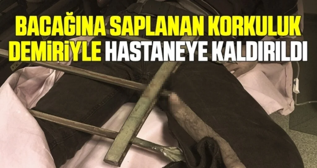 Samsun'da Bacağına saplanan korkuluk demiriyle hastaneye kaldırıldı