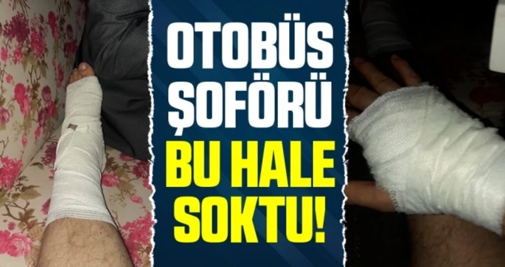 Samsun'da Otobüs Şoförü Bu Hale Soktu!