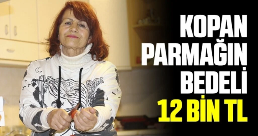 Kopan parmağın bedeli 12 bin TL