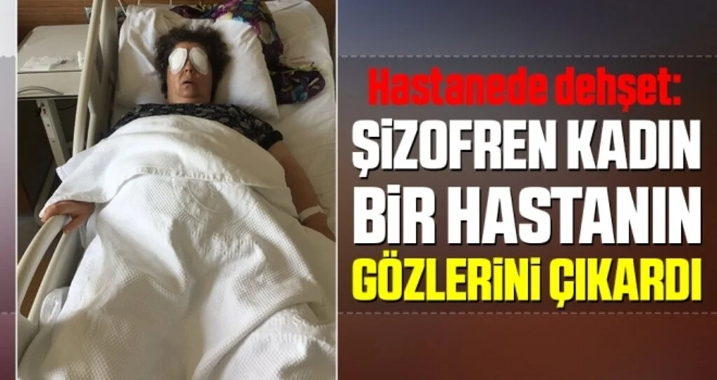 Hastanede Dehşet: Şizofren Kadın, Bir Hastanın Gözlerini Çıkardı