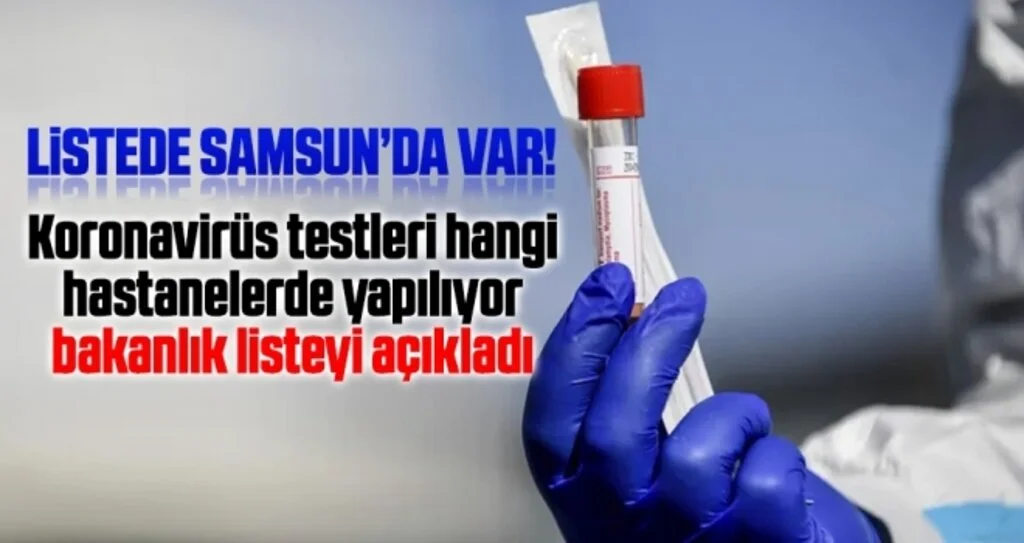 Koronavirüs Testleri Hangi Hastanelerde Yapılıyor Bakanlık Listeyi Açıkladı