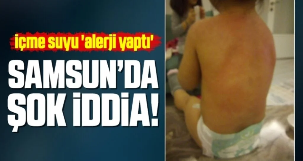 Samsun'da İçme Suyu 'Alerji Yaptı' İddiası