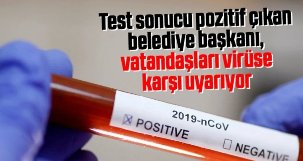 Test sonucu pozitif çıkan belediye başkanı, vatandaşları virüse karşı uyarıyor