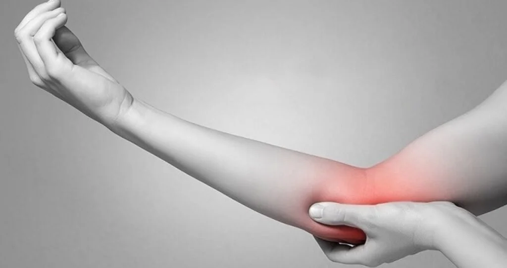 Tenisçi Dirseği (Lateral Epikondilit) Nedir, Nasıl Tedavi Edilir ?